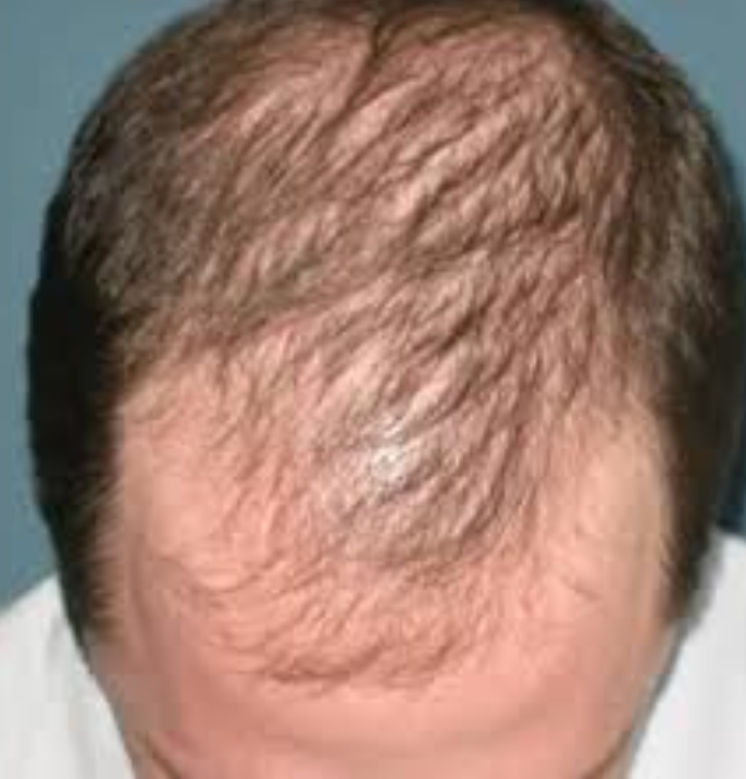 Hair Growth Massage Oil Blend